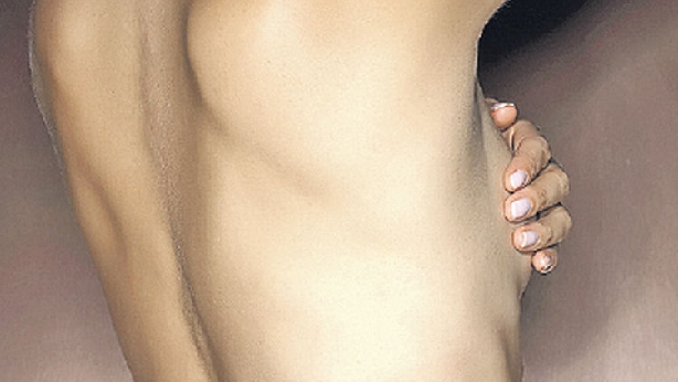 Cáncer de seno previsible en 72% de casos