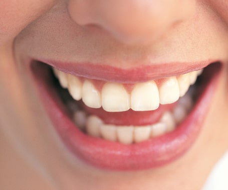 La cosmética dental también debe hacer parte de tu vida